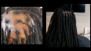 PT 1 WHY YOUR LOCS ARE FAR APART [upl. by Samson]