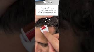 How To Use The StimuRoller Derm Roller  Micro needling for Hair Loss amp Stimulate Hair Growth [upl. by Lebatsirc]