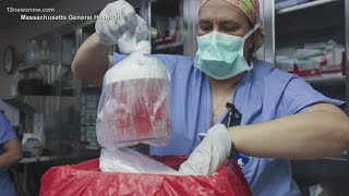 Successful pig kidney transplant into human [upl. by Ayidah]