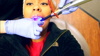 ✗ Braces Update Vlog 2  Tooth Extractions  Spacers  More ✗ [upl. by Ffilc]