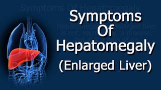 Symptoms Of Hepatomegaly Enlarged Liver [upl. by Ko818]