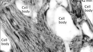 Microglial cell migrating through live mouse brain parenchyma [upl. by Maura]