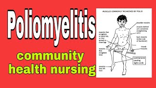 poliomyelitis in hindi  community health nursing  bsc nursing 2nd year [upl. by Vasos]