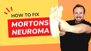 Shooting Sharp Foot Pain  Mortons Neuroma  Treatment No Surgery [upl. by Refynnej]