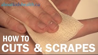 How to treat cuts and scrapes  Comment traiter les coupures et les éraflures  SickKids [upl. by Tnomed]