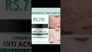 Anti acne Gelyoutubeshortsyoutubeytshortsshopping [upl. by Shaner122]