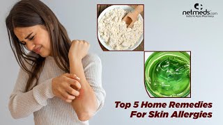 5 Best Natural Remedies For Skin Allergies [upl. by Aiouqes869]