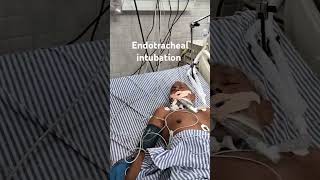 ENDOTRACHEAL INTUBATION  EMERGENCY PROCEDURES [upl. by Melisent641]