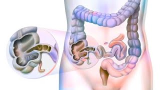 Large intestine  Caecum amp Appendix Part 2 [upl. by Ayatahs]