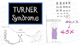 What is Turner Syndrome HealthSketch [upl. by Norbert]