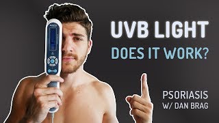 UVB Light Removed 97 Of My Psoriasis [upl. by Ahtera]