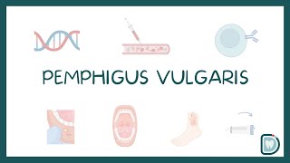 Pemphigus Vulgaris Oral Cavity Symptoms and Treatment [upl. by Inman]