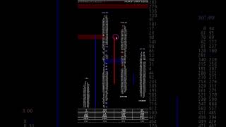 How To Read A Footprint Chart footprintcharts orderflowtrading futurestrading tradingstrategy [upl. by Harim307]