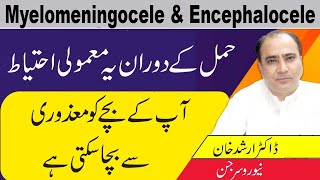 Myelomeningocele And Myelomeningocele CausesSymptoms And Treatment In Urdu [upl. by Eliezer253]