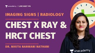 Must know Imaging Signs in Chest X ray and HRCT Chest  Dr Nikita [upl. by Ienttirb]