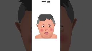 What is Down Syndrome tata1mg downsyndromeawareness [upl. by Anilyx]