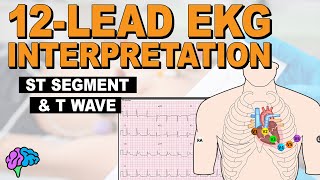 The ST Segment and T Wave REVIEW [upl. by Nosaj197]