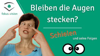 Schielen und seine Folgen – Augentraining hilft [upl. by Brightman]