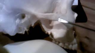 Zygomatic bone Nasal bone Lacrimal bone Inferior nasal conchae [upl. by Ellehc]