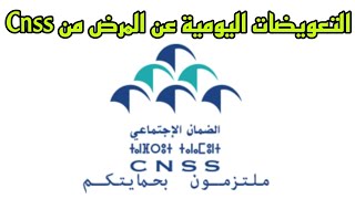 التعويضات اليومية عن المرض من Cnss [upl. by Leaj]