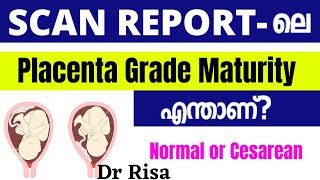 Placenta Grade in Scan Report Malayalam  Placenta Position [upl. by Cinamod456]