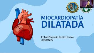 Miocardiopatía Dilatada Chagásica Dr Ext Joshua Santizo [upl. by Ari]