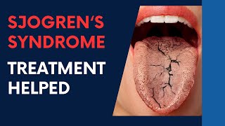 Sjogrens Syndrome Treatment HELPED by Dr Suh [upl. by Wilhide]