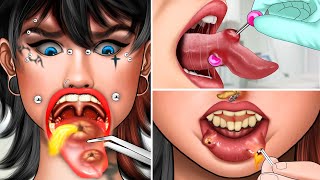 ASMR Treating Inflammation tongue piercings popping pus animation Body modification [upl. by Beatty]