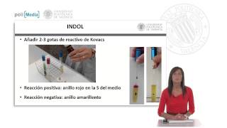 IMVIC Indol Rojo de metilo VogesProskauer Citrato   UPV [upl. by Thibaut]