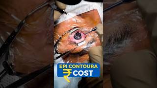 EPI Contoura Surgery Cost [upl. by Puett]