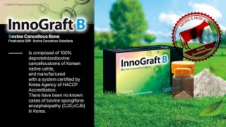 New Product Launch Introducing InnoGraft B with Clinical Case [upl. by Nalyt987]