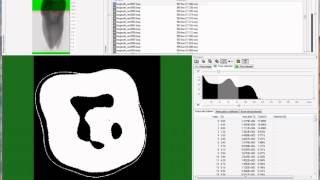 MicroCT morphometry of the tooth part 2 enamel and dentine [upl. by Quinby620]