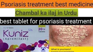 kuniz tablet uses in Urdukuniz tablet for psoriasisapremilast uses in Hindichambal ka ilaj [upl. by Melisenda675]