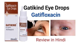 Gatikind Eye Drops Gatifloxacin Review in Hindi [upl. by Dahraf]