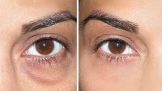 How to Cover Dark Circles  Under Eye Bags [upl. by Arreic]