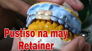 DenturePustiso with Retainer How you like that Retainer in the Philippines [upl. by Ahse]