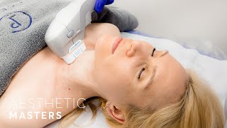 HIFU Treatment  Face and Neck Lift [upl. by Gnouhp]