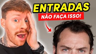 ENTRADAS NO CABELO 5 Estilos de CORTES MASCULINOS ANIMAIS pra você Aderir [upl. by Tandie]