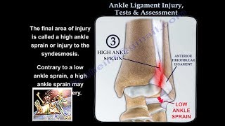 Ankle Ligament Injury evaluation and tests  Everything You Need To Know  Dr Nabil Ebraheim [upl. by Llertnek593]