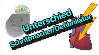 Was ist der Unterschied zwischen einem Defibrillator und einem Schrittmacher [upl. by Jarnagin928]