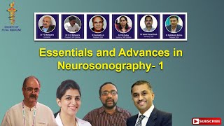 Essentials and Advances in Neurosonogrraphy1 [upl. by Spencer]