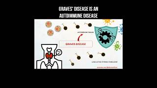 Graves disease is an autoimmune disease basedow gravesdisease autoimmunedisease thyroid [upl. by Sileas]