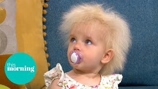 Meet The Toddler With UltraRare Wild Hair Diagnosis  This Morning [upl. by Allegra166]