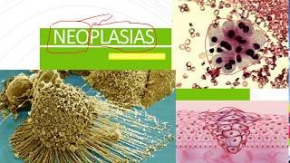 Patologia Geral  Neoplasias [upl. by Akcirahs]