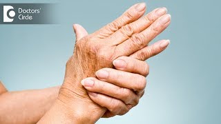 Can arthritis and rheumatism be treated by homeopathy Dr Aradhana Chitra [upl. by Marteena263]