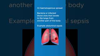 Lung Abscess  Causes of lung abscess  clinical features of lung abscess shortsvideo [upl. by Aelyak]