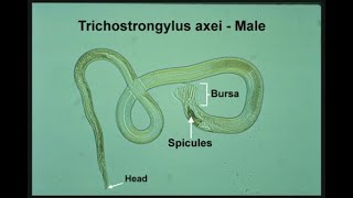 TrichoStrongylus  Species Life cycle Transmission Disease Symptoms Diagnosis Treatment [upl. by Tada298]