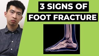 Foot Fracture How to Identify Foot Fracture after Ankle Sprain Top 3 Signs [upl. by Koffman261]