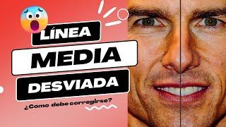 LA LÍNEA MEDIA DENTAL DESVIADA 😱 Y SU RELACIÓN CON UN ROSTRO ASIMETRICO  ¿CÓMO SE DEBE CORREGIR [upl. by Ambrosia]