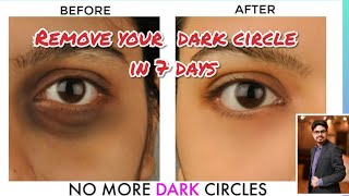 Ferulac peel for dark circle removal [upl. by Ahselrac]